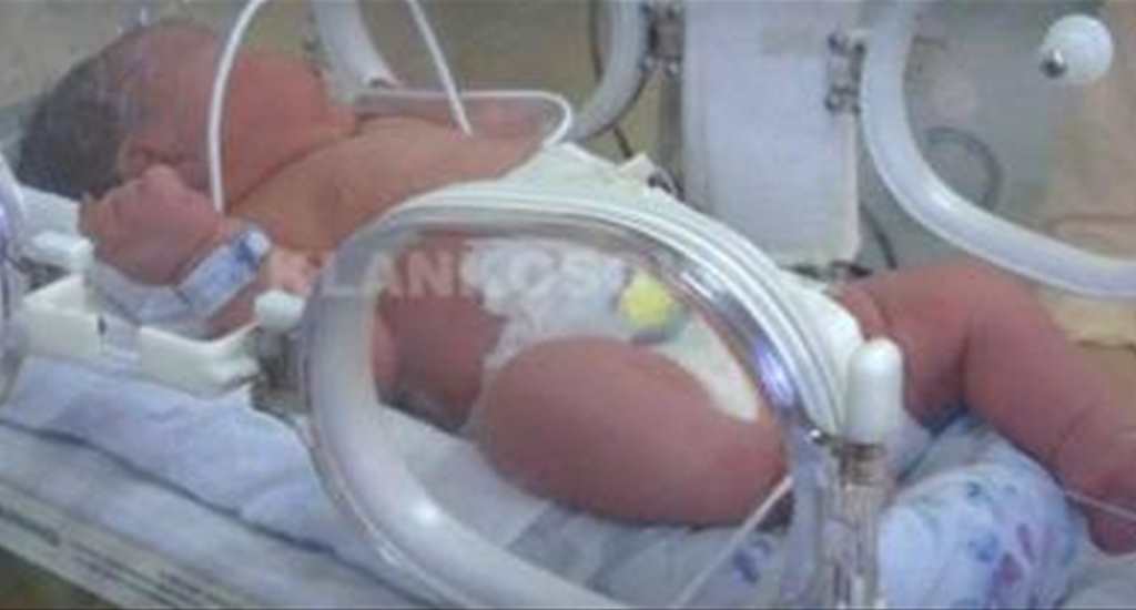 Kosovada 6.2 Kg Ağırlığında Bebek Doğdu